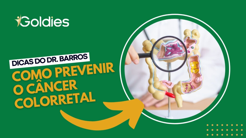 Dicas do Dr. Barros: como prevenir o câncer colorretal